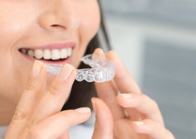 Ortodontija, Top-Dental