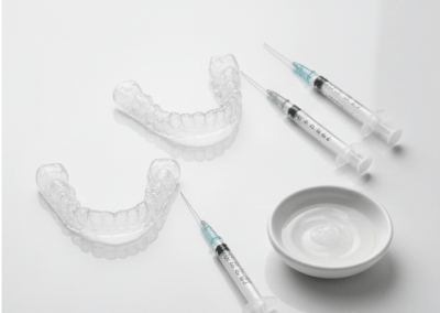 Beljenje zob v Top-Dental